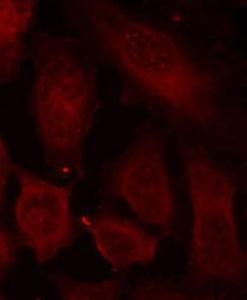 Immunofluorescence analysis of methanol-fixed HeLa cells using Anti-DOK2 (phospho Tyr299) Antibody (A10905)