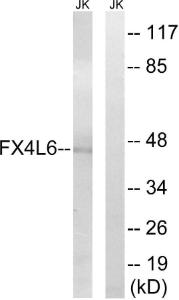 Western blot analysis of lysates from Jurkat cells using Anti-FOXD4 + L2 + L3 + L4 + L5 + L6 Antibody. The right hand lane represents a negative control, where the antibody is blocked by the immunising peptide.