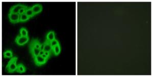 Immunofluorescence analysis of MCF7 cells using Anti-FPR1 Antibody. The right hand panel represents a negative control, where the antibody was pre-incubated with the immunising peptide