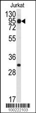 Anti-STAT5B Rabbit Polyclonal Antibody