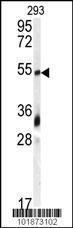 Anti-GDF10 Rabbit Polyclonal Antibody (FITC (Fluorescein))