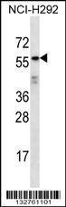 Anti-ODF2L Rabbit Polyclonal Antibody (AP (Alkaline Phosphatase))