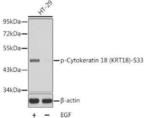 Anti-Cytokeratin 18