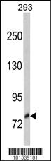 Anti-NTRK3 Rabbit Polyclonal Antibody