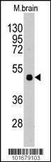 Anti-PI4K2A Rabbit Polyclonal Antibody (AP (Alkaline Phosphatase))