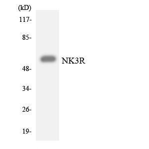 Anti-NK3R antibody