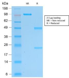 SDS-PAGE analysis of Anti-PGP9.5 Antibody [rUCHL1/775] under non-reduced and reduced conditions; showing intact IgG and intact heavy and light chains, respectively. SDS-PAGE analysis confirms the integrity and purity of the antibody