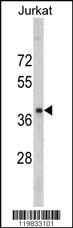 Anti-RRM2 Rabbit Polyclonal Antibody