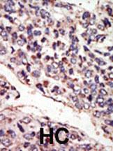 Anti-NTRK3 Rabbit Polyclonal Antibody