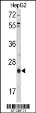 Anti-TGIF1 Rabbit Polyclonal Antibody