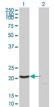 Anti-SSSCA1 Mouse Monoclonal Antibody [clone: 2H4]