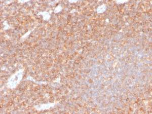 Immunohistochemical analysis of formalin-fixed, paraffin-embedded human tonsil using Anti-CD44 Antibody [HCAM/4110R]