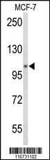 Anti-EEF1G Rabbit Polyclonal Antibody