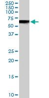 Anti-VPS45 Goat Polyclonal Antibody