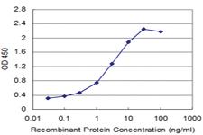 Anti-SMARCA2 Mouse Monoclonal Antibody [clone: 2D12]