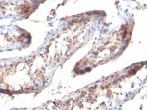 Immunohistochemical analysis of formalin-fixed, paraffin-embedded human testicular carcinoma using Anti-TGF alpha Antibody [SPM357]