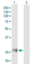 Anti-HLA-DRB4 Mouse Polyclonal Antibody