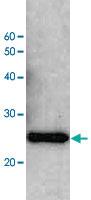 Anti-Escherichia coli LexA Rabbit Polyclonal Antibody