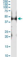 Anti-PTRF Antibody Pair