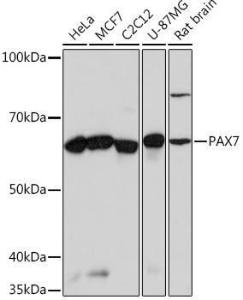 Anti-PAX7 Rabbit Monoclonal Antibody [clone: ARC0914]