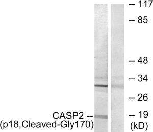 Western blot analysis of lysates from Jurkat cells, treated with etoposide 25uM 24h using Anti-Caspase 2 (p18,cleaved Gly170) Antibody. The right hand lane represents a negative control, where the antibody is blocked by the immunising peptide.