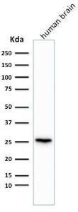 Western blot analysis of human brain tissue lysate using Anti-PGP9.5 Antibody [rUCHL1/775]