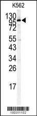 Anti-STAT2 Rabbit Polyclonal Antibody