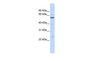 Anti-IGFALS Rabbit Polyclonal Antibody