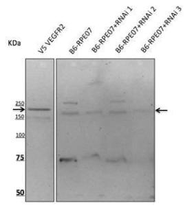 Anti-VEGFR2 antibody at a 1:500 dilution and rabbit anti-goat IgG antibody (HRP) at a 1:10,000 dilution