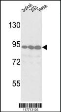 Anti-DDR2 Rabbit Polyclonal Antibody