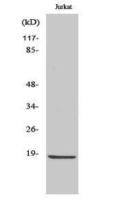 Western blot analysis of Jurkat cells using Anti-Caspase 2 (p18,cleaved Gly170) Antibody