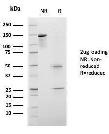 SDS-PAGE analysis of Anti-CELA3B Antibody [rCELA3B/1811] under non-reduced and reduced conditions; showing intact IgG and intact heavy and light chains, respectively. SDS-PAGE analysis confirms the integrity and purity of the antibody