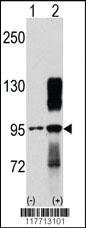 Anti-DDR2 Rabbit Polyclonal Antibody