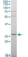 Anti-RPS9 Mouse Polyclonal Antibody