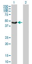 Anti-SMARCB1 Mouse Polyclonal Antibody