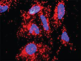 Anti-IL10 + A2M Antibody Pair