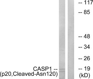 Western blot analysis of lysates from rat eye cells using Anti-Caspase 1 (p20,cleaved Asn120) Antibody. The right hand lane represents a negative control, where the antibody is blocked by the immunising peptide.