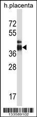 Anti-ITLN2 Rabbit Polyclonal Antibody (Biotin)