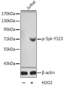 Western blot analysis of extracts from Jurkat cells using Anti-Syk (phospho Tyr323) Antibody (A10913). The secondary antibody was Goat Anti-Rabbit IgG HandL Antibody (HRP) at 1:10,000 dilution. Lysates/proteins were present at 25 µg per lane. The blocking buffer used was 3% BSA