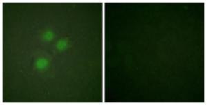 Immunofluorescence analysis of HUVEC cells using Anti-NIFK Antibody. The right hand panel represents a negative control, where the antibody was pre-incubated with the immunising peptide.