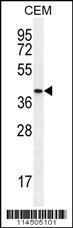 Anti-OGN Rabbit Polyclonal Antibody (APC (Allophycocyanin))