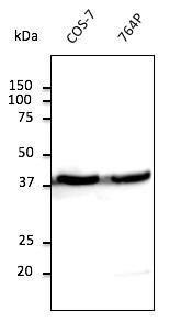 Antibody anti-beta actin 600 µg