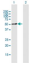 Anti-TFDP2 Rabbit Polyclonal Antibody