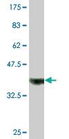 Anti-ADAMDEC1 Mouse Monoclonal Antibody [clone: 1G2]