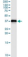 Anti-IL1B Polyclonal Antibody Pair