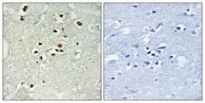 Immunohistochemical analysis of paraffin-embedded human brain using Anti-DNA Ligase 4 (phospho Thr650) Antibody 1:100 (4 °C overnight). The right hand panel represents a negative control, where the Antibody was pre-incubated with the immunising peptide