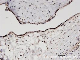 Anti-RPS11 Mouse Monoclonal Antibody [clone: 2A5]