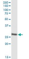 Anti-DCXR Polyclonal Antibody Pair