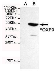 Anti-FOXP3 Mouse Monoclonal Antibody [clone: 13k55]