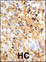 Anti-DOK1 Rabbit Polyclonal Antibody